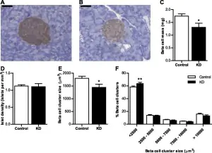 Studie Beta-Zellen
