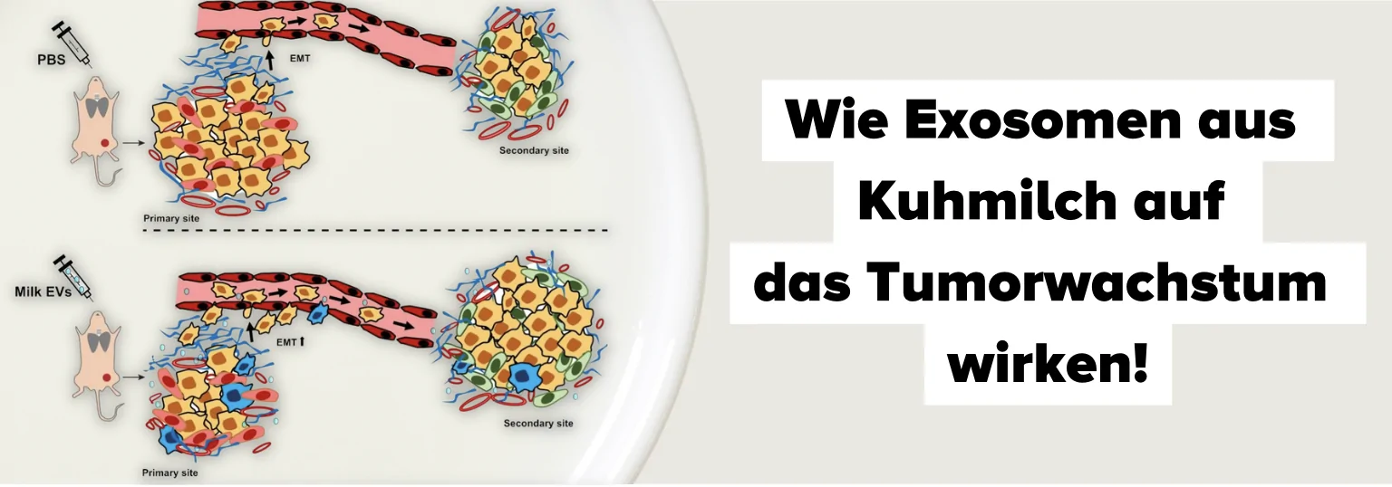 exosomen tumor milch krebs
