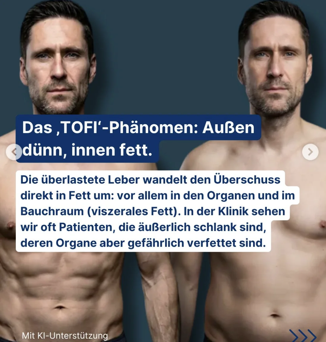 Viszerales fett ist nicht subkutanes Fett Viszerales fett ist nicht subkutanes Fett